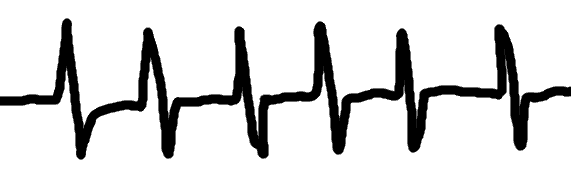 électrocardiogramme - dessin